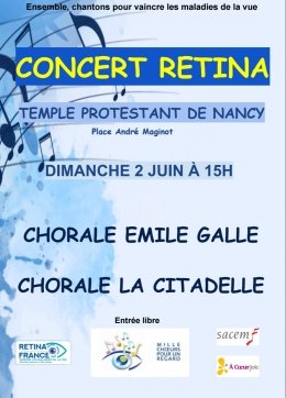 Concert Retina